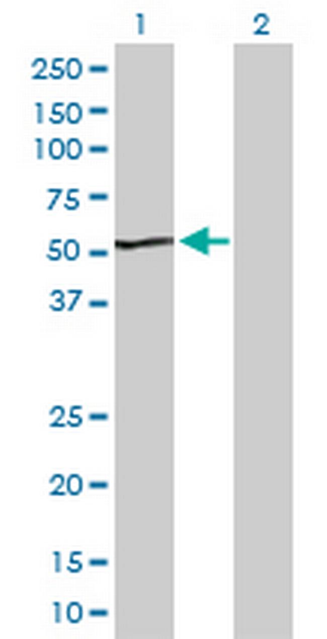 ACADS Antibody in Western Blot (WB)