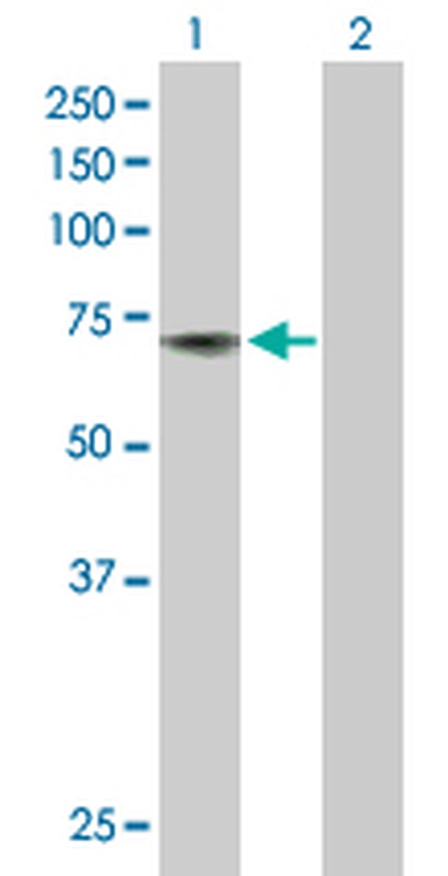 ACHE Antibody in Western Blot (WB)