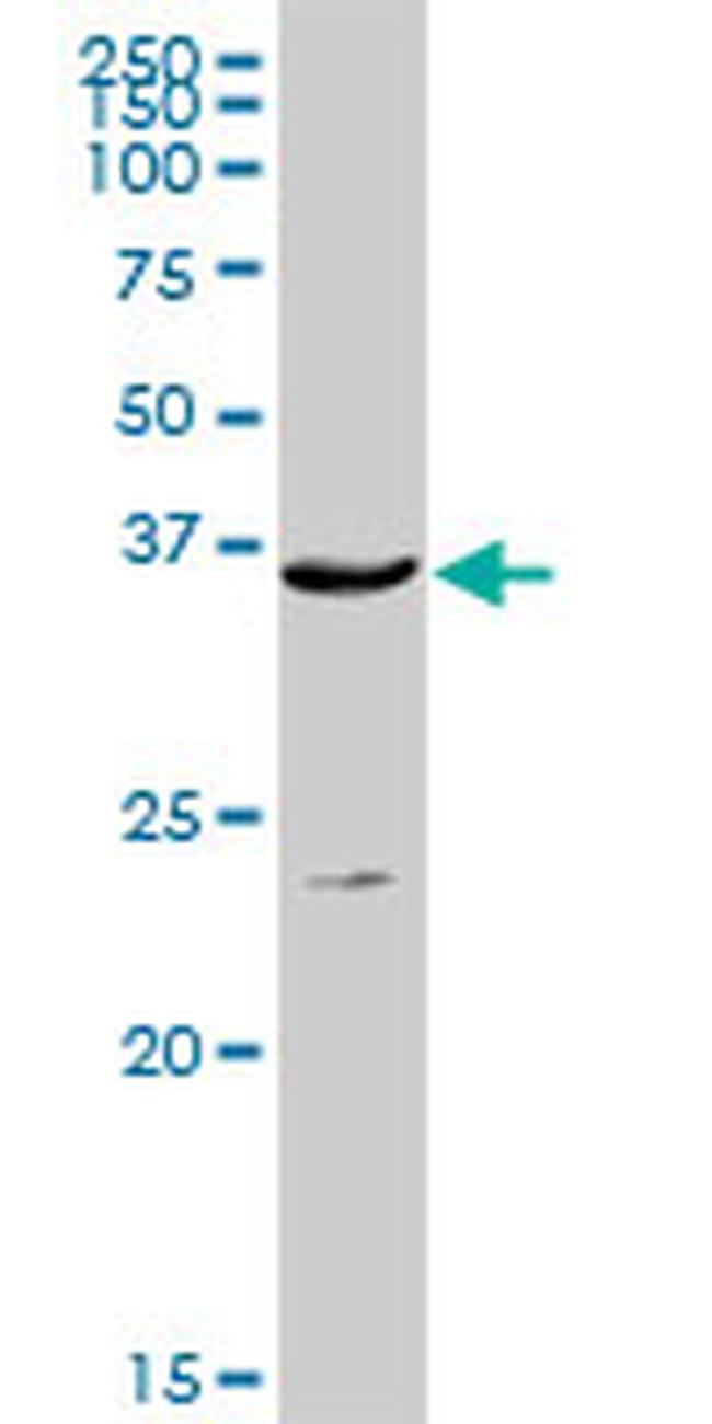 ACP5 Antibody in Western Blot (WB)