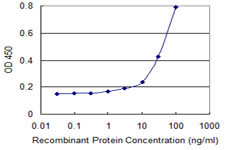 ACP5 Antibody in ELISA (ELISA)