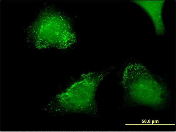 ACP5 Antibody in Immunocytochemistry (ICC/IF)