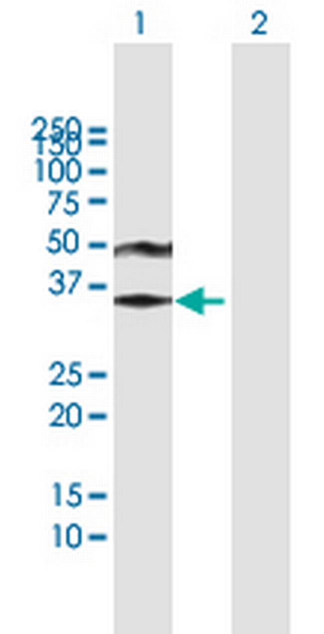 ACRV1 Antibody in Western Blot (WB)