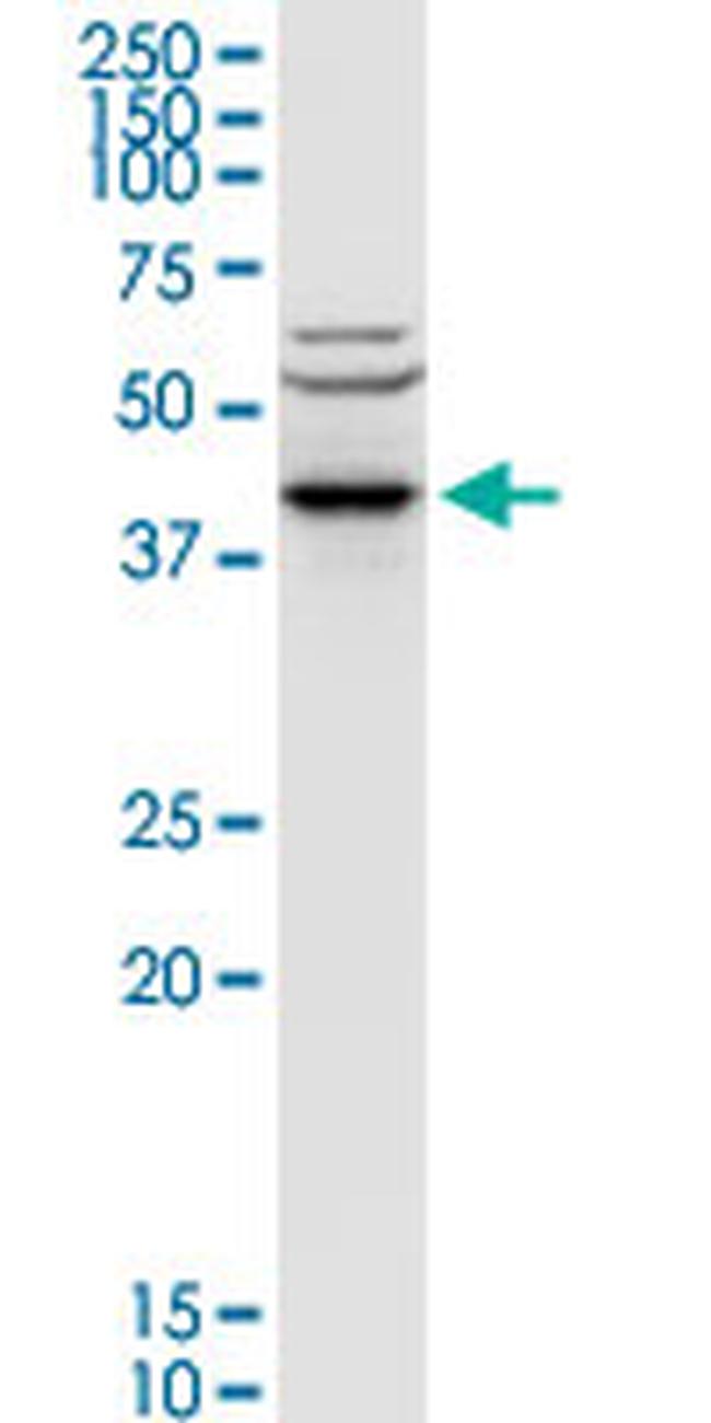 ACY1 Antibody in Western Blot (WB)