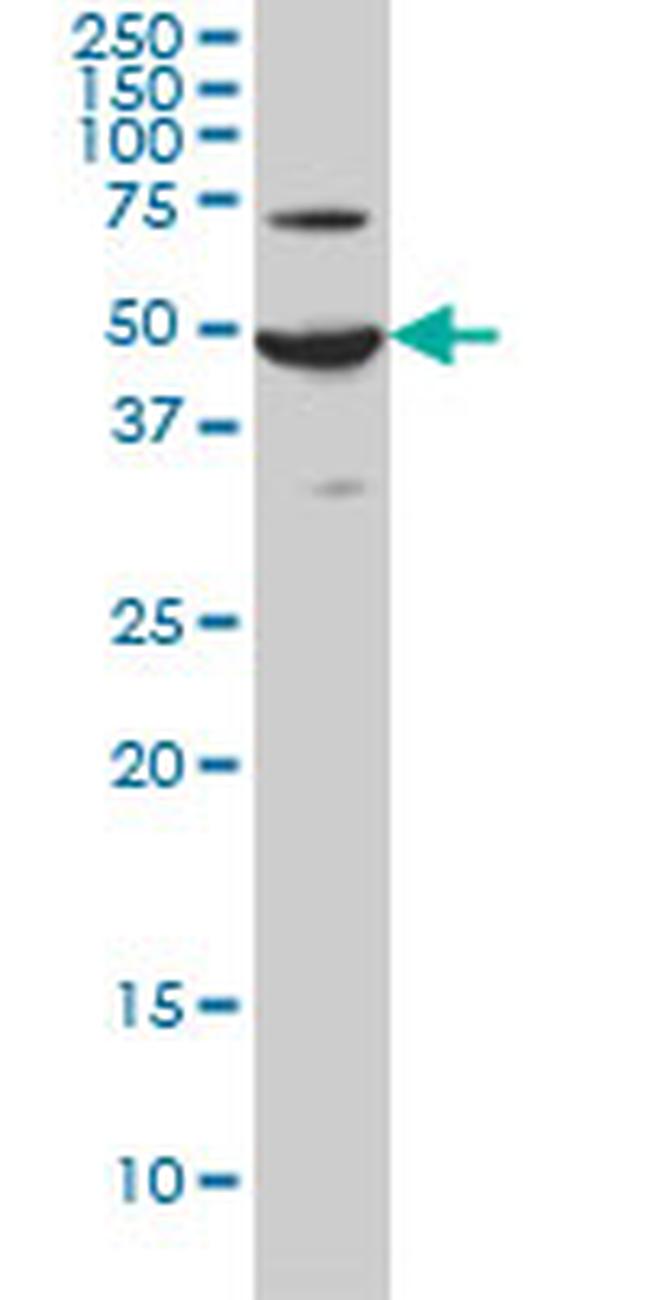 ADCYAP1R1 Antibody in Western Blot (WB)