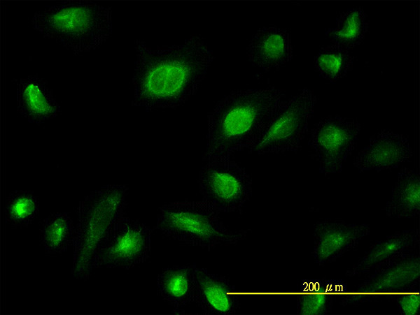 AK1 Antibody in Immunocytochemistry (ICC/IF)