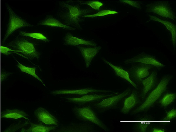 ALOX15B Antibody in Immunocytochemistry (ICC/IF)