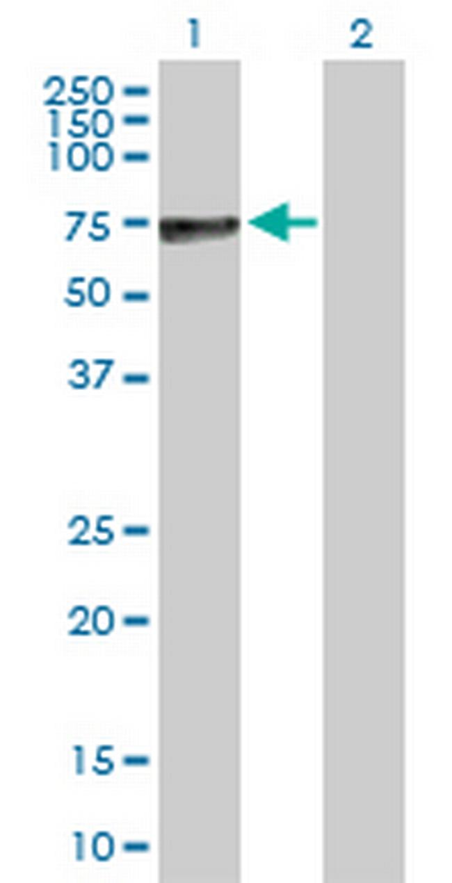 ALPP Antibody in Western Blot (WB)