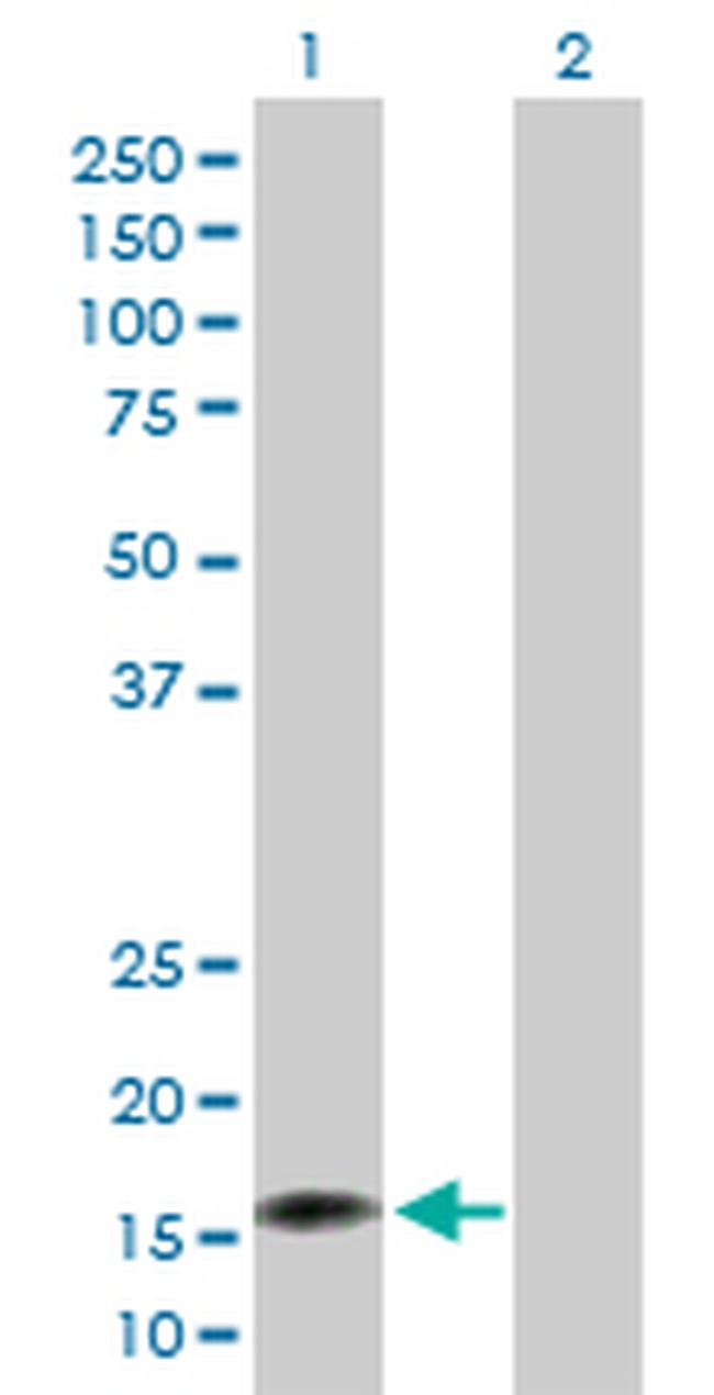 NUDT2 Antibody in Western Blot (WB)