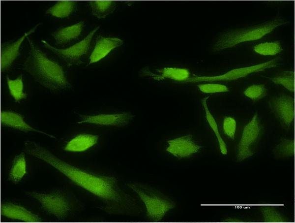 BIRC4 Antibody in Immunocytochemistry (ICC/IF)