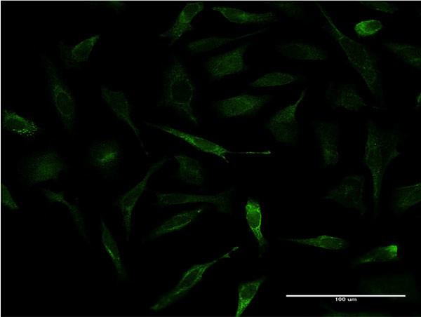 APOA2 Antibody in Immunocytochemistry (ICC/IF)