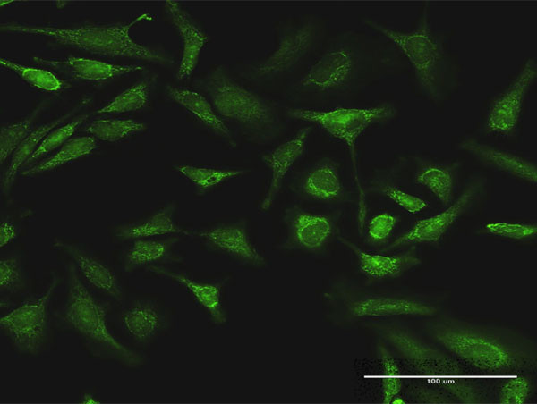 ARAF Antibody in Immunocytochemistry (ICC/IF)