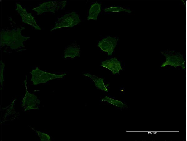 RHOC Antibody in Immunocytochemistry (ICC/IF)