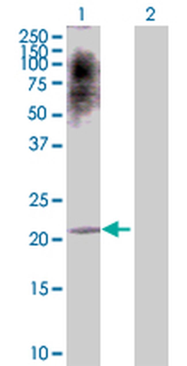 ATF3 Antibody in Western Blot (WB)