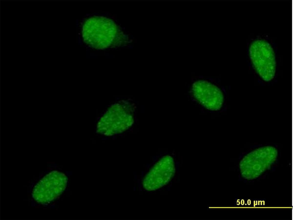 ATOH1 Antibody in Immunocytochemistry (ICC/IF)