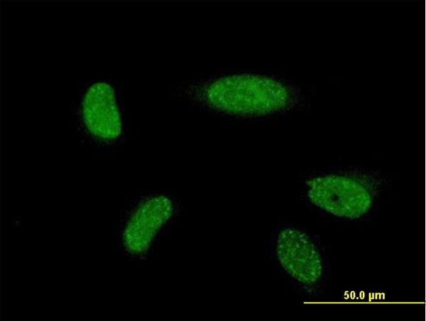 ATOH1 Antibody in Immunocytochemistry (ICC/IF)