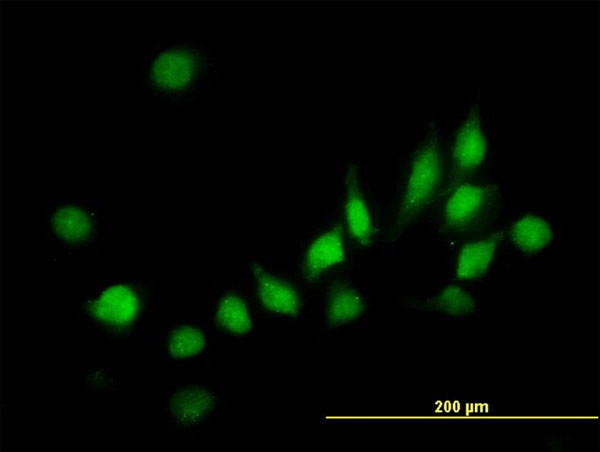 ATOX1 Antibody in Immunocytochemistry (ICC/IF)