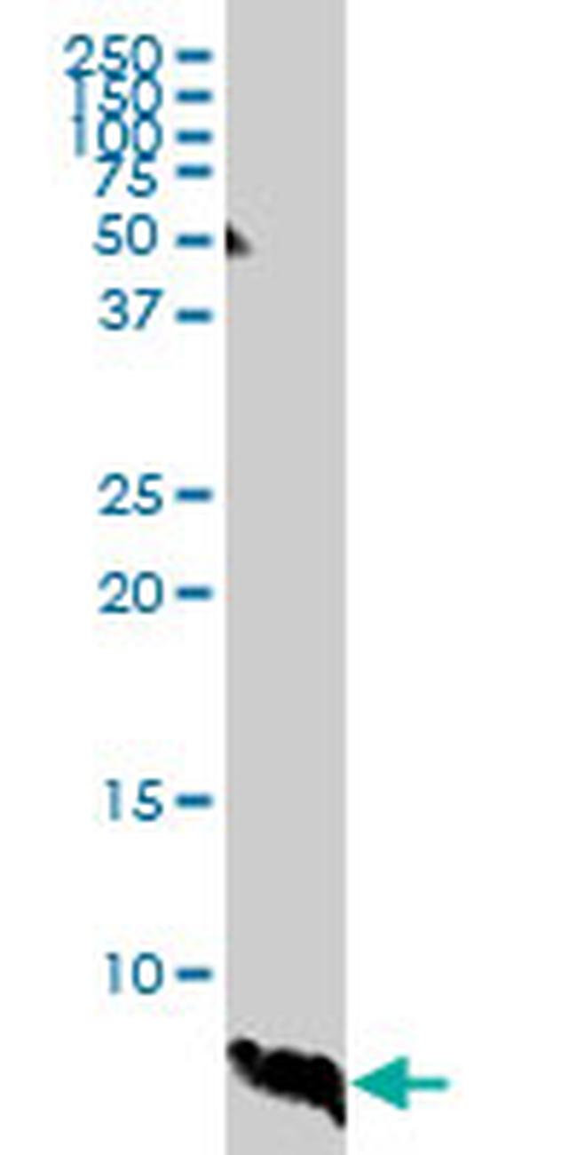 ATOX1 Antibody in Western Blot (WB)