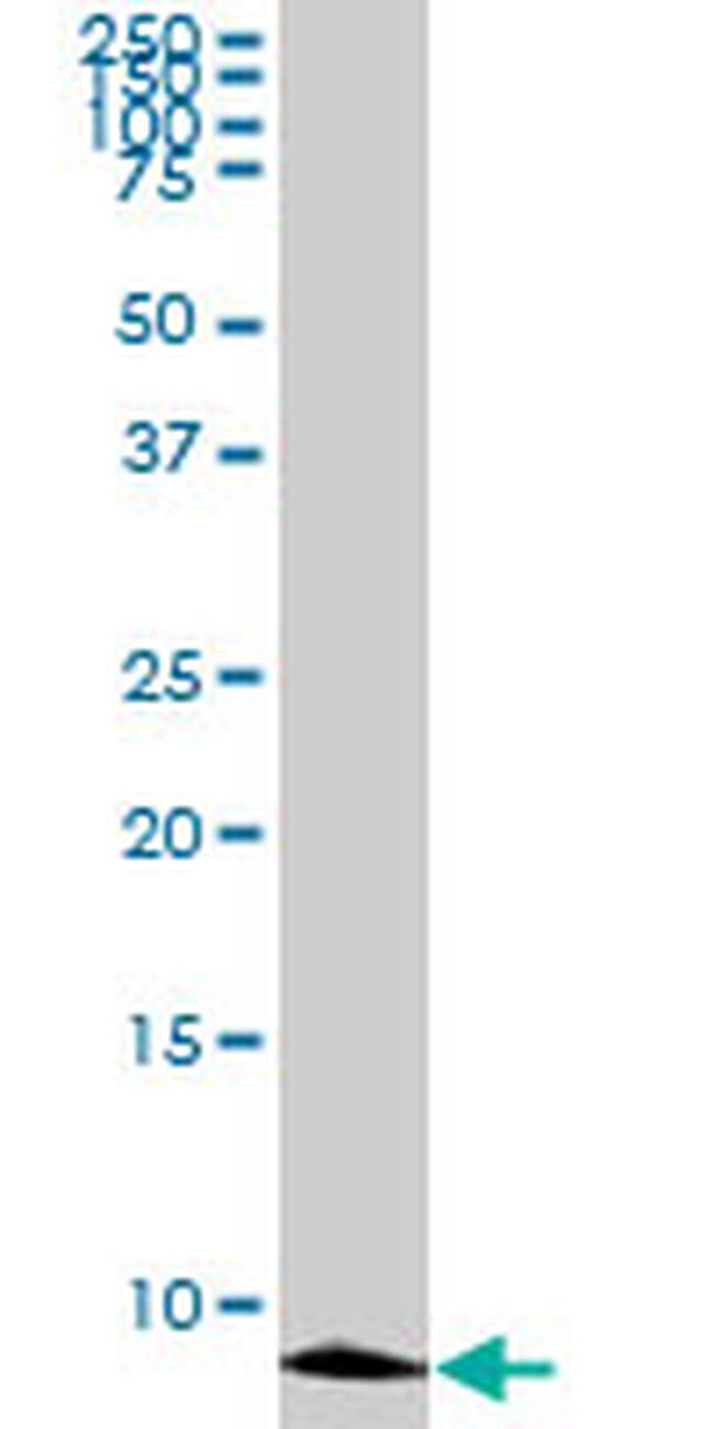 ATOX1 Antibody in Western Blot (WB)