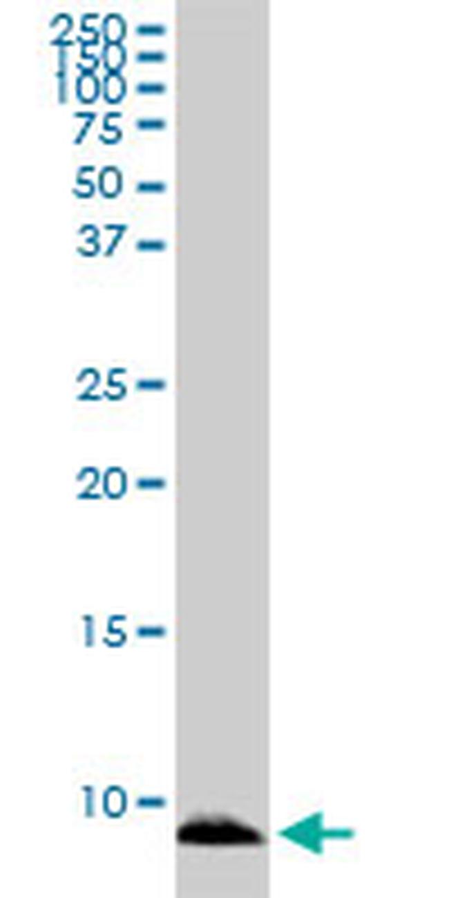 ATOX1 Antibody in Western Blot (WB)