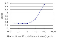 ATP6V1B2 Antibody in ELISA (ELISA)