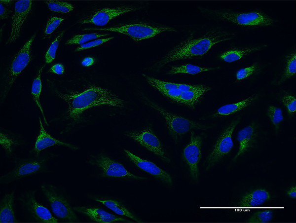 ATP5O Antibody in Immunocytochemistry (ICC/IF)