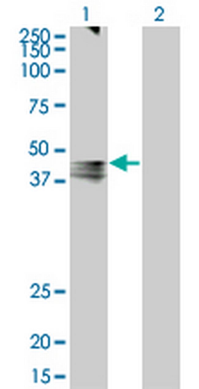 AVPR1A Antibody in Western Blot (WB)