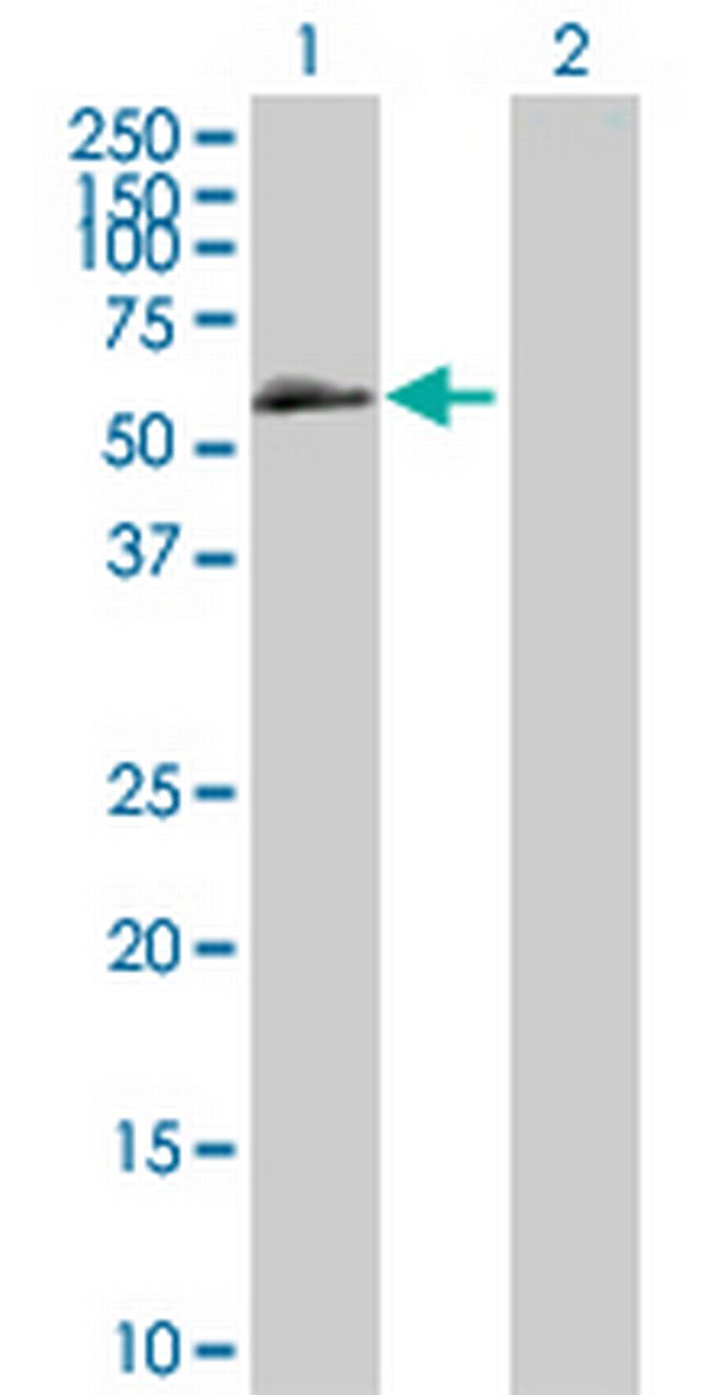 BMPR1B Antibody in Western Blot (WB)