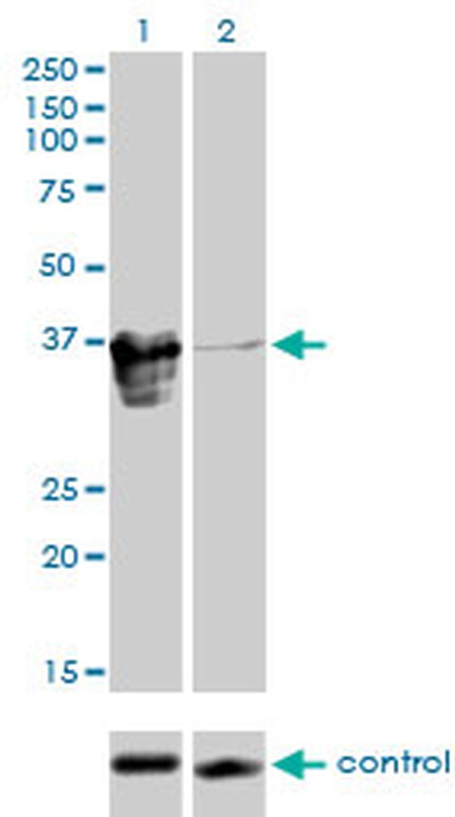 ZFP36L1 Antibody in Western Blot (WB)