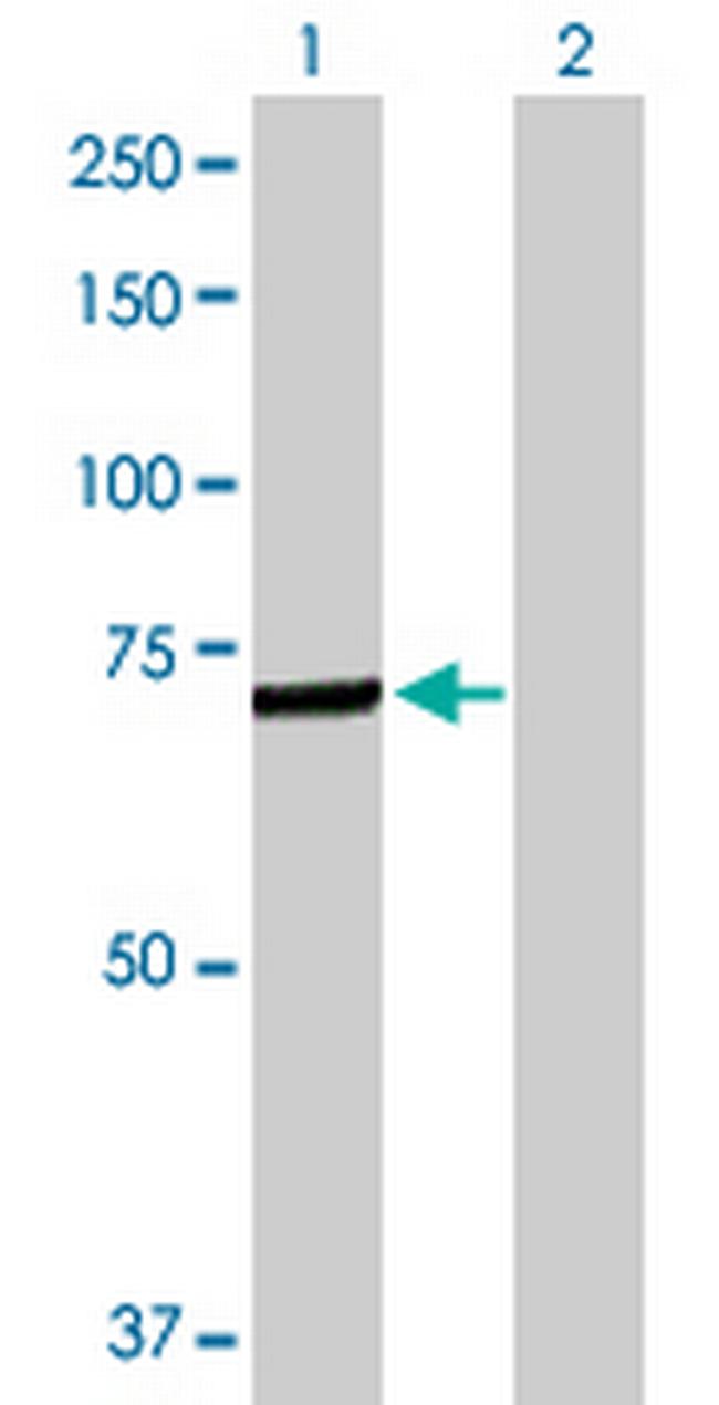 C4BPA Antibody in Western Blot (WB)