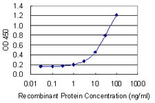 CA6 Antibody in ELISA (ELISA)