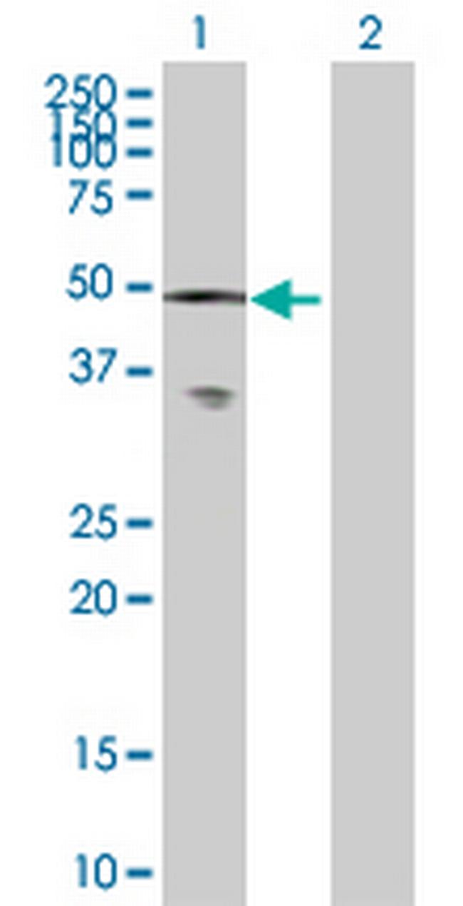 CAMK2A Antibody in Western Blot (WB)