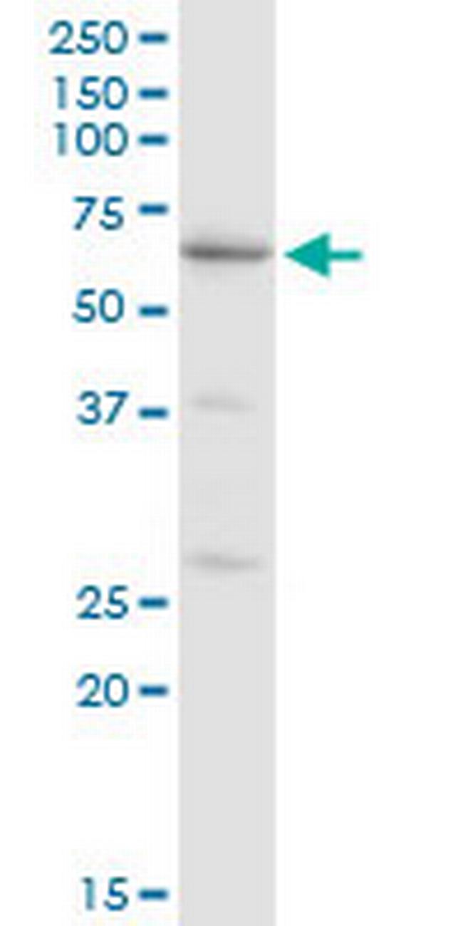 CAT Antibody in Western Blot (WB)