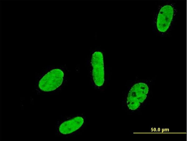 RUNX2 Antibody in Immunocytochemistry (ICC/IF)