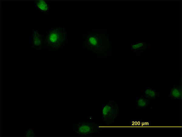 RUNX1 Antibody in Immunocytochemistry (ICC/IF)