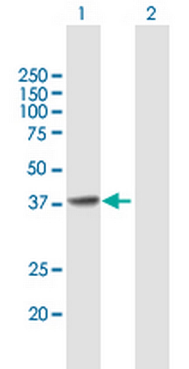 CDK6 Antibody in Western Blot (WB)