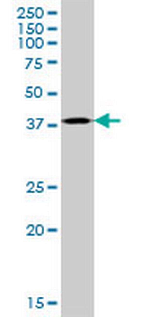 CDK6 Antibody in Western Blot (WB)