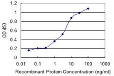 RCBTB2 Antibody in ELISA (ELISA)