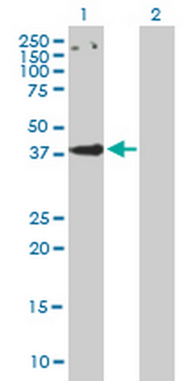 CCBP2 Antibody in Western Blot (WB)