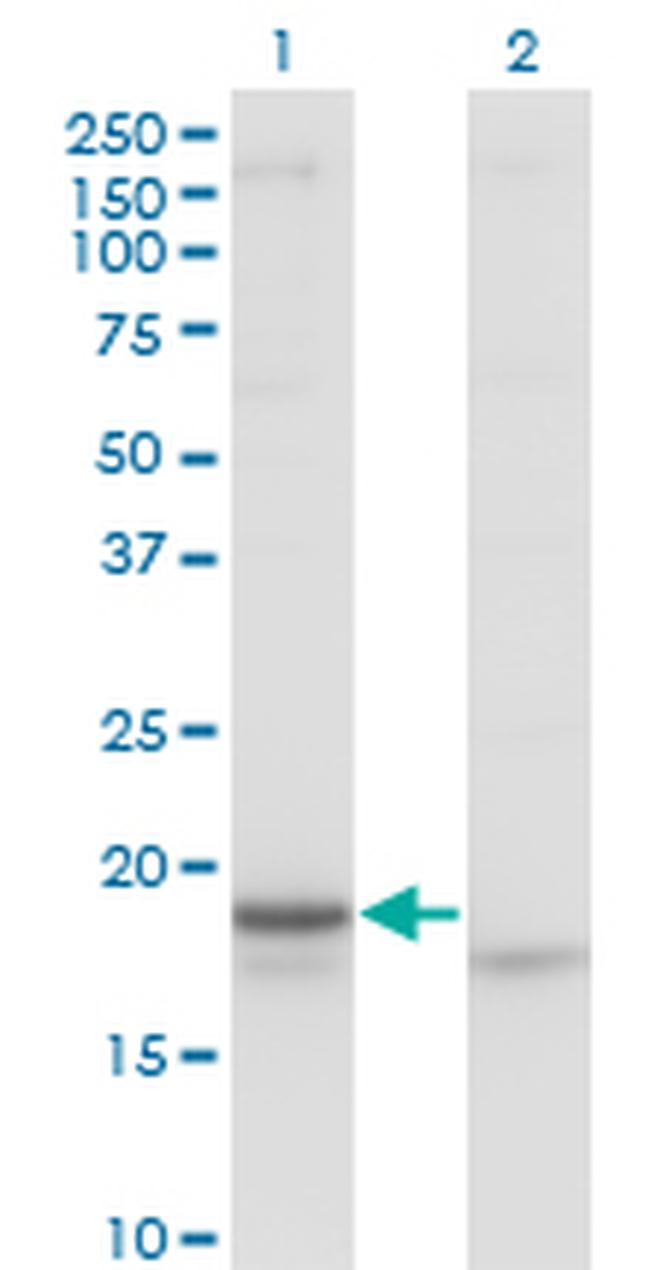 CRH Antibody in Western Blot (WB)