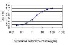 CRYM Antibody in ELISA (ELISA)