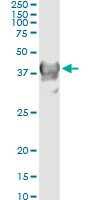 CRYM Antibody in Immunoprecipitation (IP)