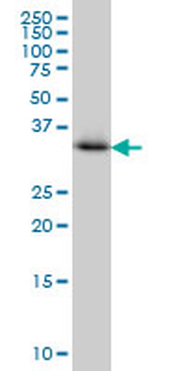 CRYM Antibody in Western Blot (WB)