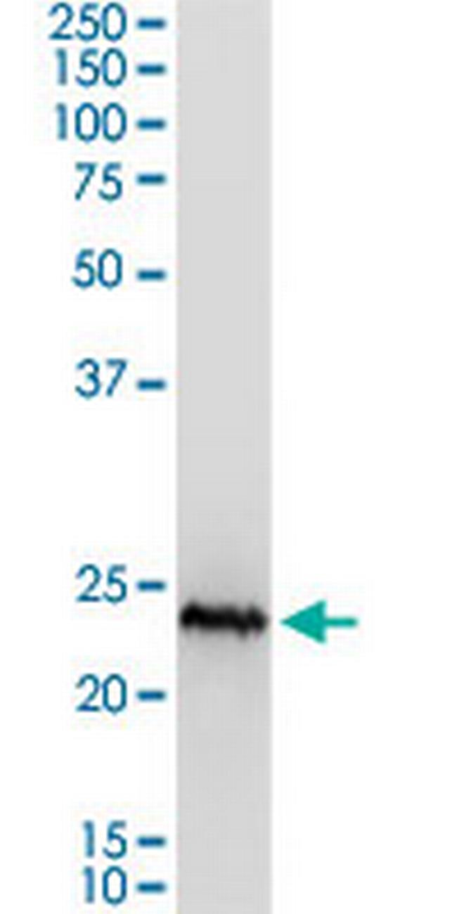 CSH1 Antibody in Western Blot (WB)