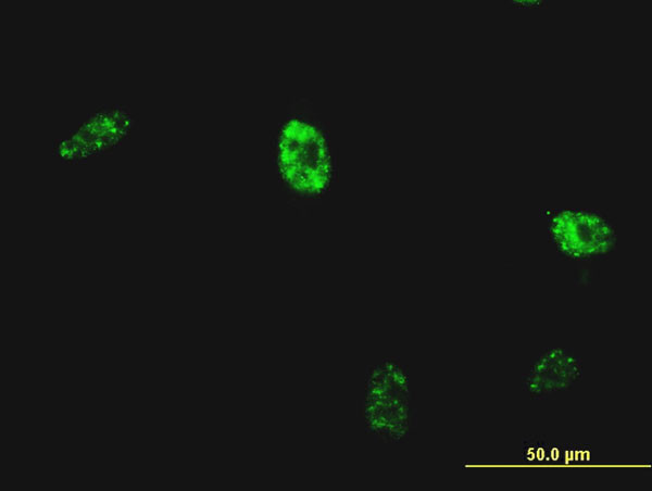 NKX2-5 Antibody in Immunocytochemistry (ICC/IF)