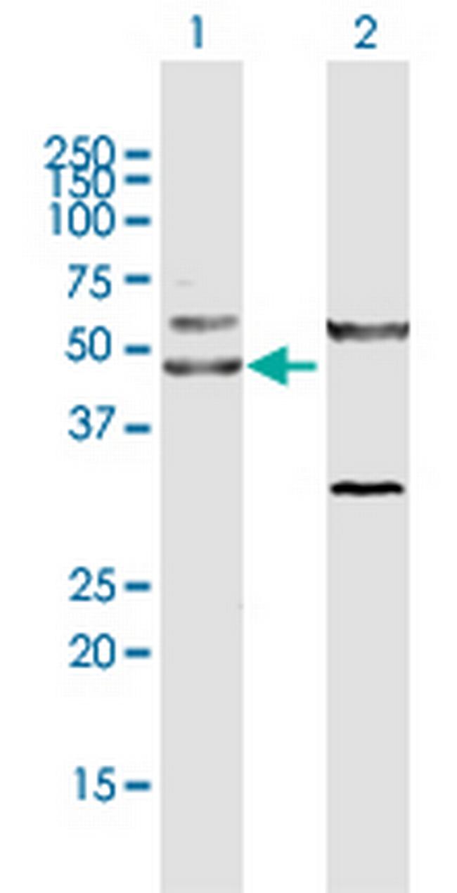 CTBP1 Antibody in Western Blot (WB)