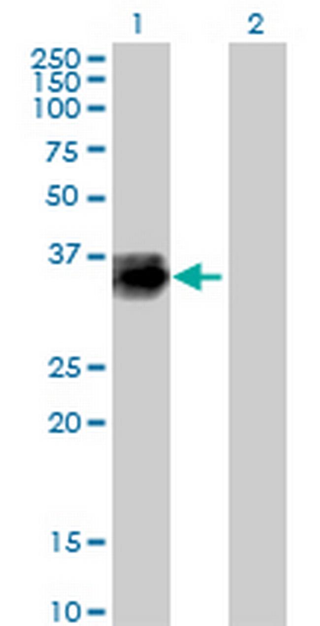 CTSZ Antibody in Western Blot (WB)