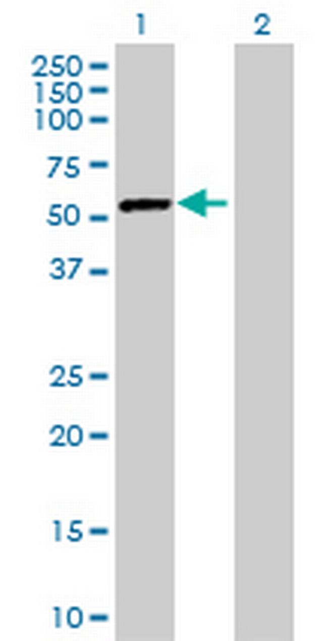 DARS Antibody in Western Blot (WB)