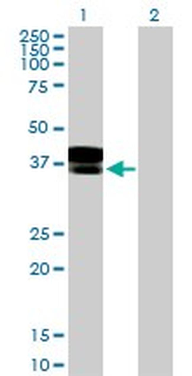 DCN Antibody in Western Blot (WB)