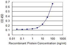 TIMM8A Antibody in ELISA (ELISA)