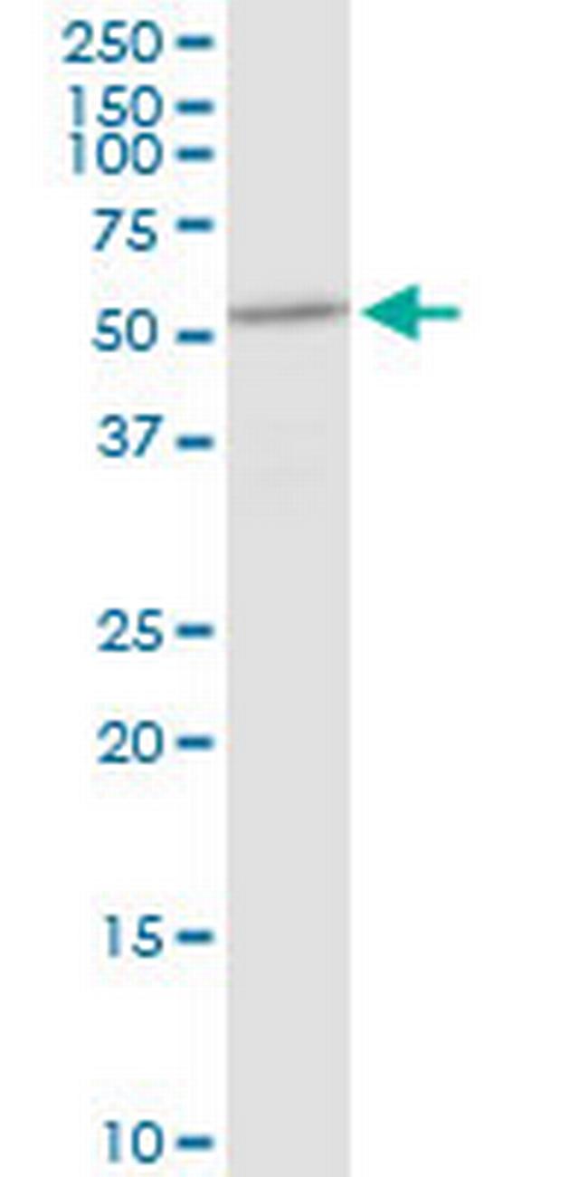 DHCR7 Antibody in Western Blot (WB)